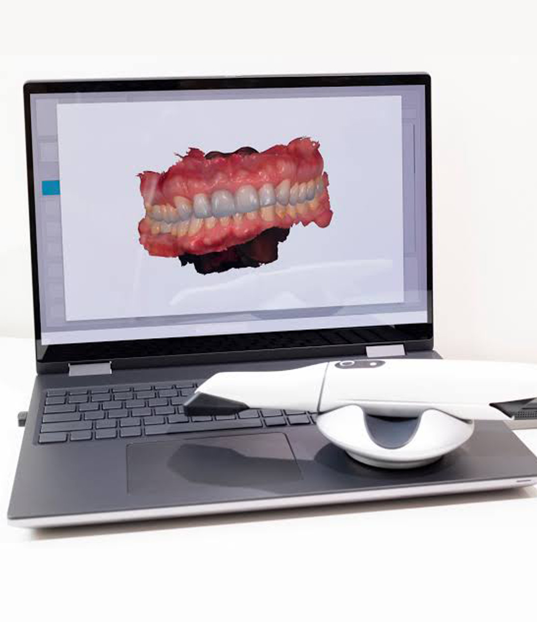The Pearl Clinic Antalya dental equipment
